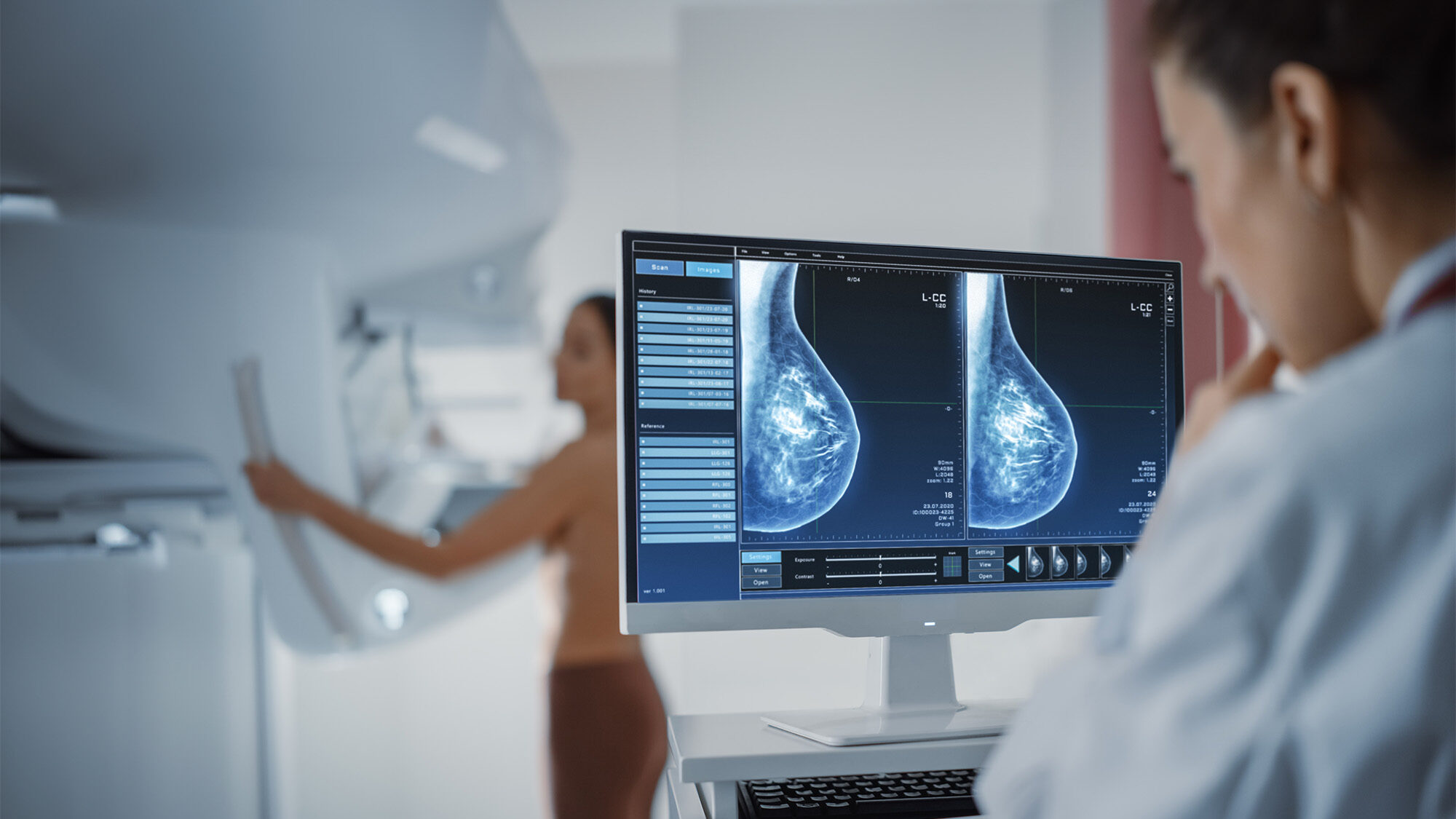 Radiologist breast imaging