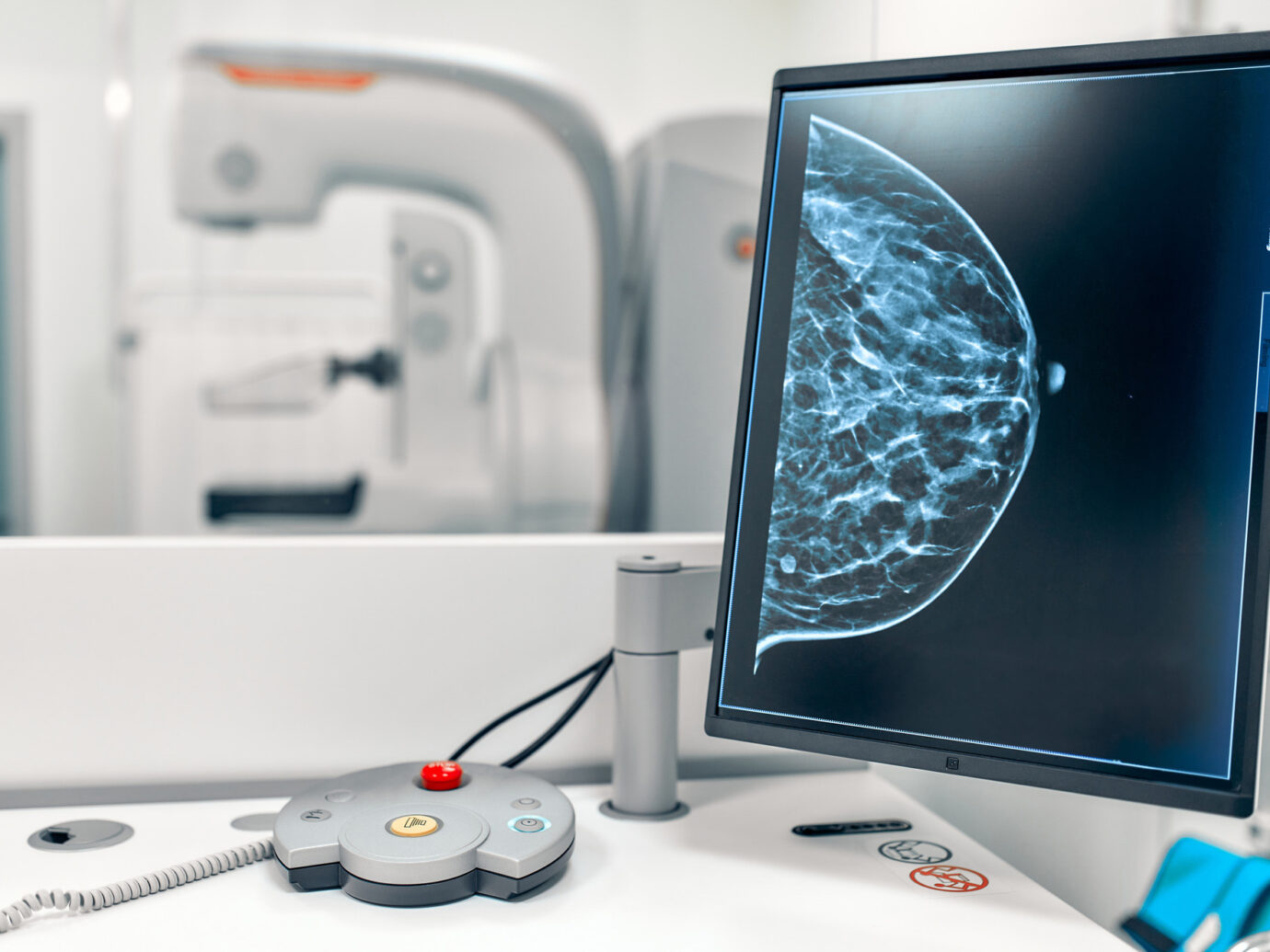 breast imaging on a screen