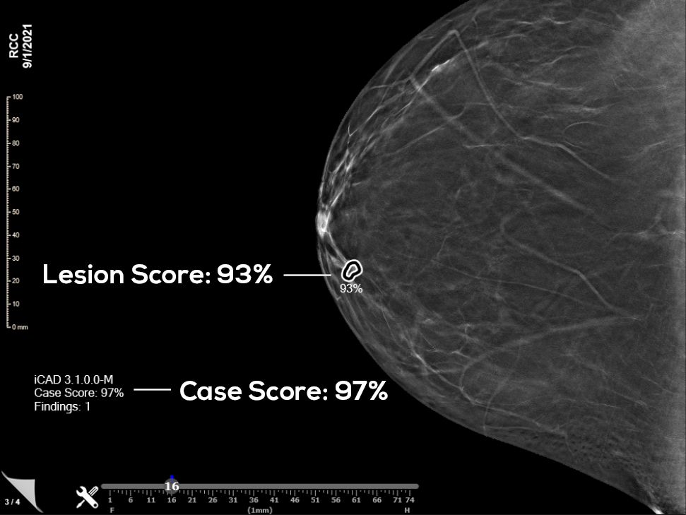 profound lesion score case score