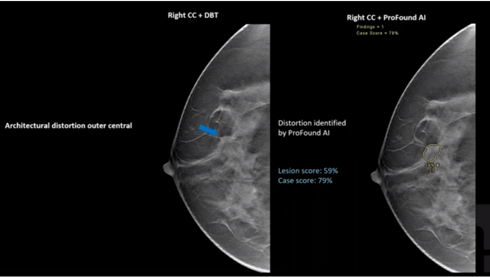 Clinical Case 2