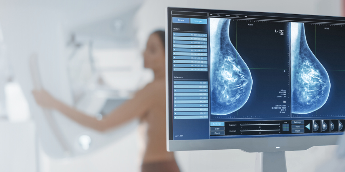 Essentials of an AI-Powered Mammography Solution