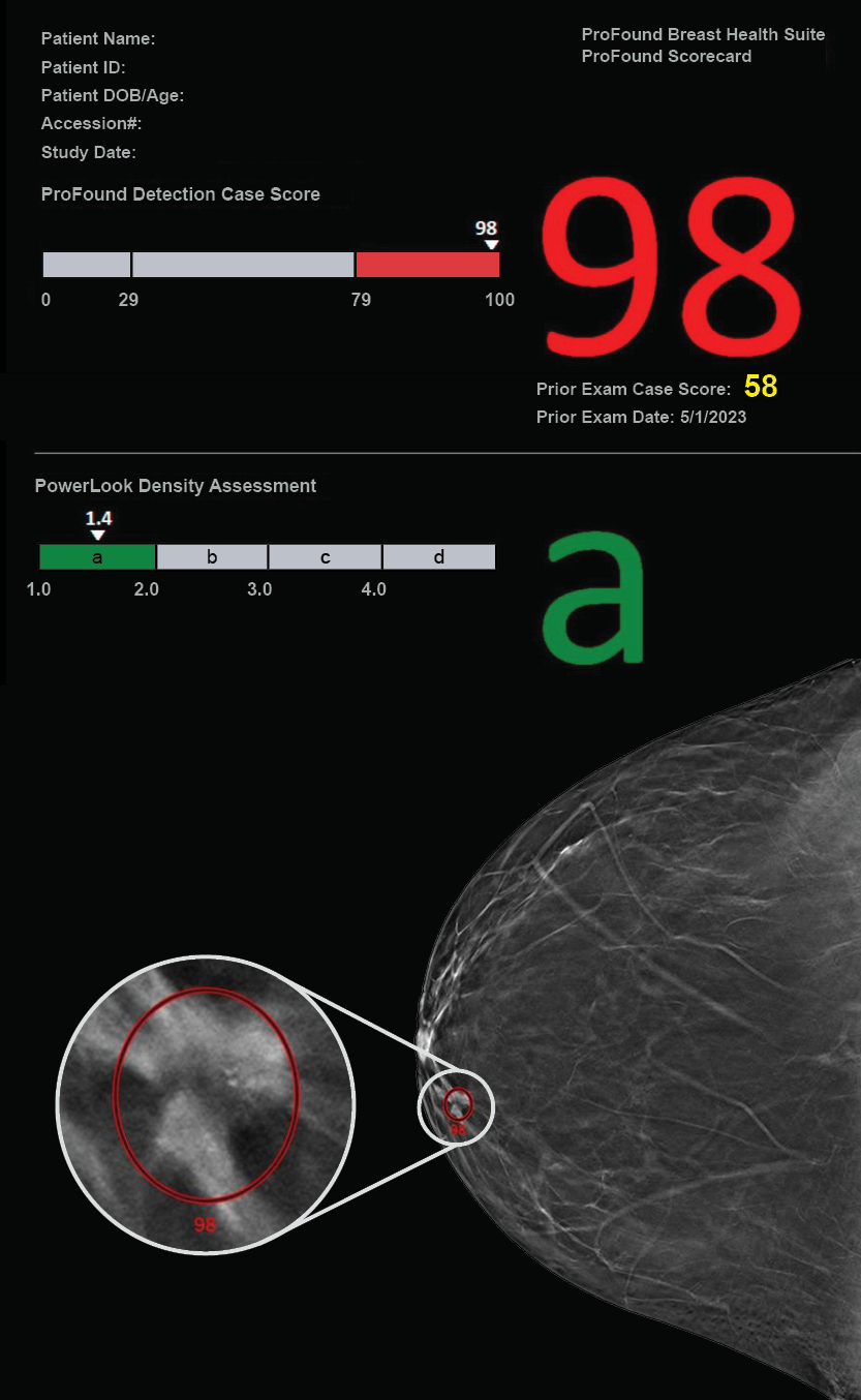 ProFound Detection with Prior