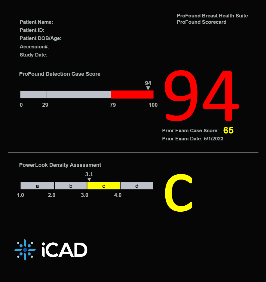 V4 Score card with Priors